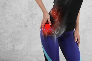 stock image of a woman holding her hip in pain. 