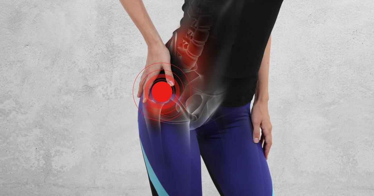 stock image of a woman holding her hip in pain.